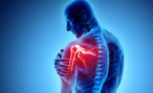 Dor muscular no ombro – Causas, prevenção e tratamento