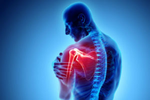 Dor muscular no ombro – Causas, prevenção e tratamento