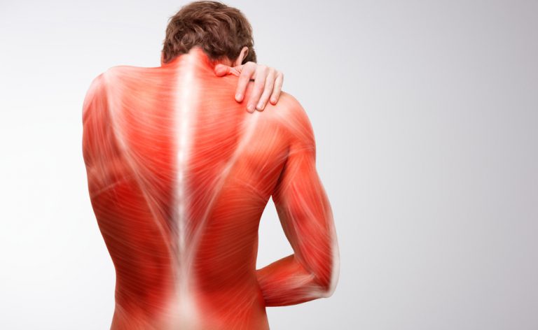Imagem representando dor nas costas. Dor muscular